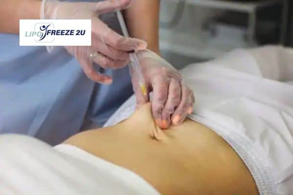 How Does Aqualyx Fat Dissolving Injection Work to Break Down Fat Nottingham?