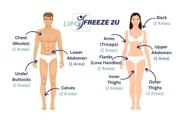 Areas you can have fat freezing treatment Nottingham