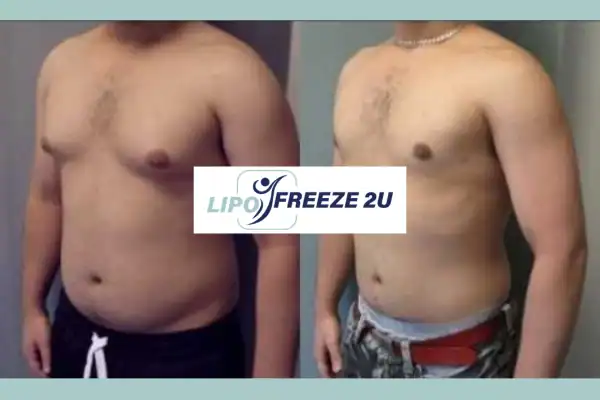 How Long Does It Take to See Results Nottingham?