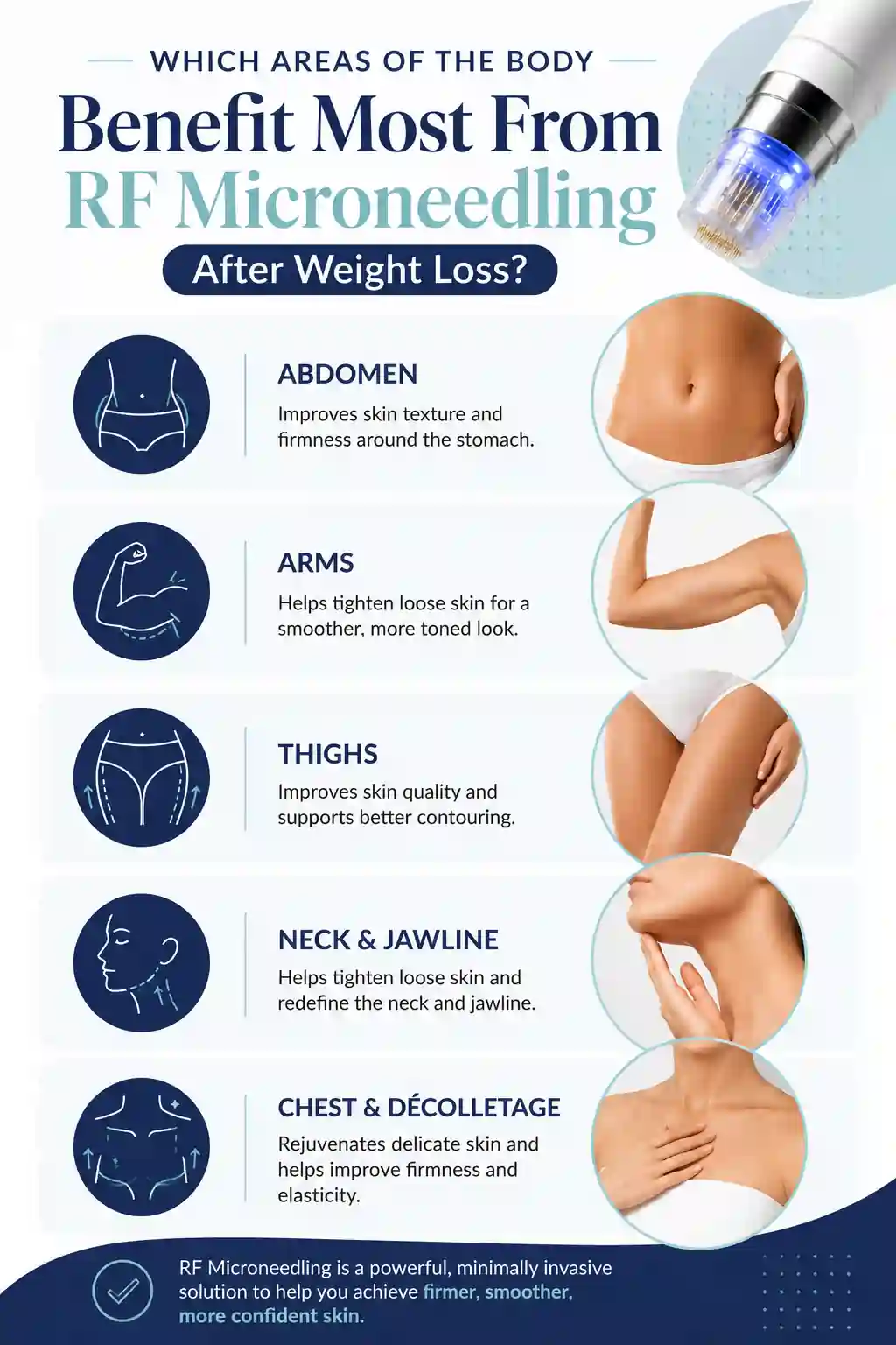 Which Areas of the Body Benefit Most From RF Microneedling After Weight Loss Nottingham